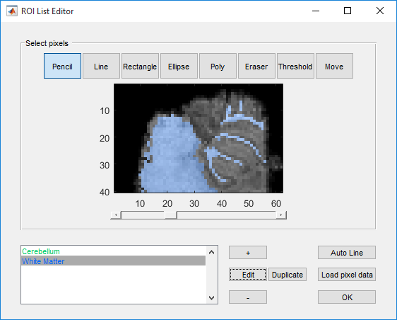 Edit a region of interest